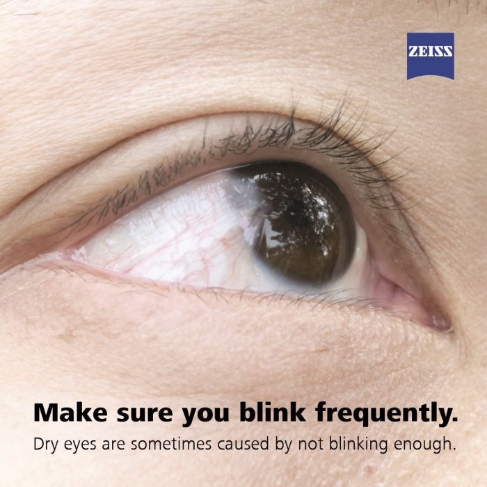 Dry eyes - blink (dry-eyes-blink.jpeg)